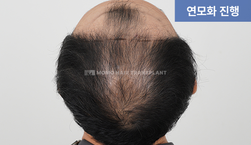 연모화 진행